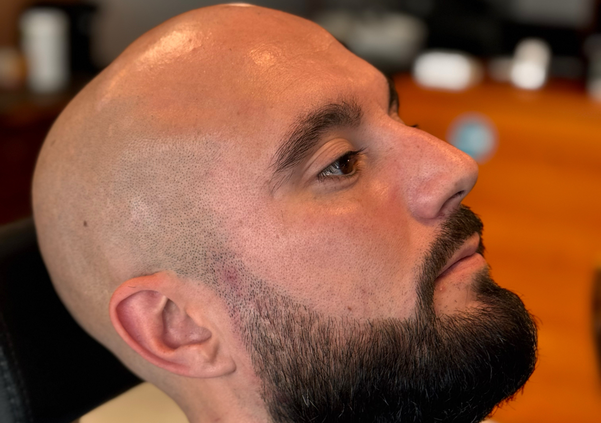 𝐑𝐀𝐒𝐀𝐆𝐄 𝐃𝐄  𝐋𝐀  𝐓𝐄𝐓𝐄 ( Tondeuse)