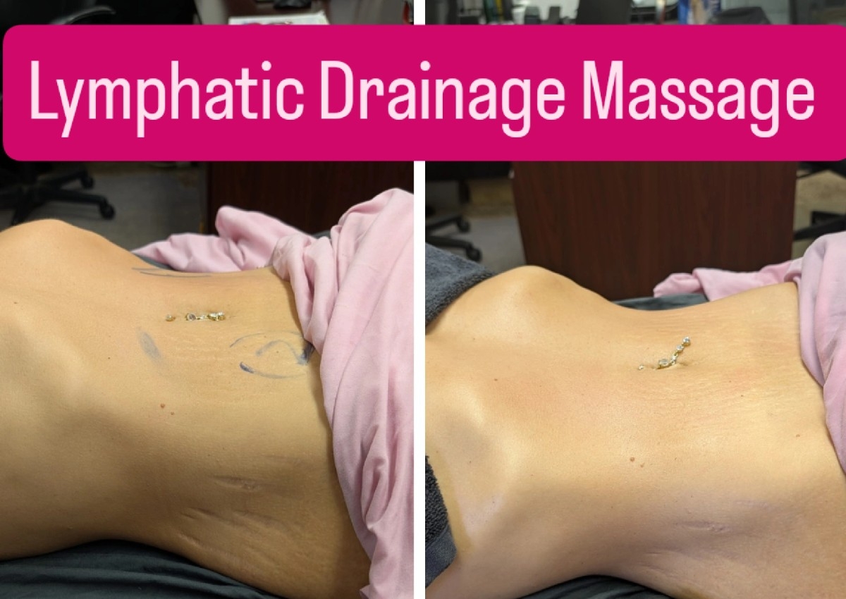 Post Surgery or  Lymphatic Drainage Massage By James