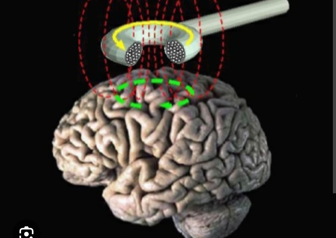 Biopsycho Therapy ( Mental Health) - 🧲🧲