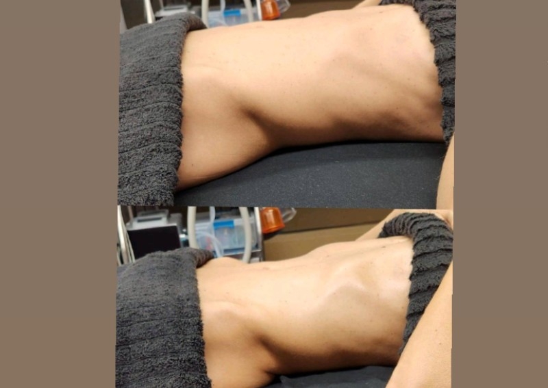 OFFICE : Brazilian Lymphatic Drainage Massage 