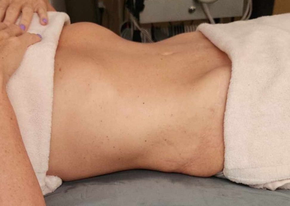 OFFICE : Face & Body Lymphatic Drainage Massage 