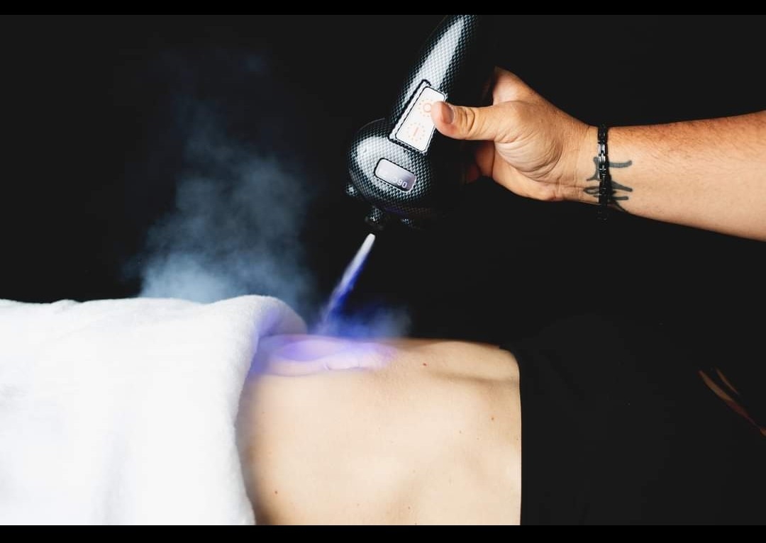 Localized Cryo Therapy+Body Sculpting ( Cellulite & Fat Reduction ) By James & Nancy 