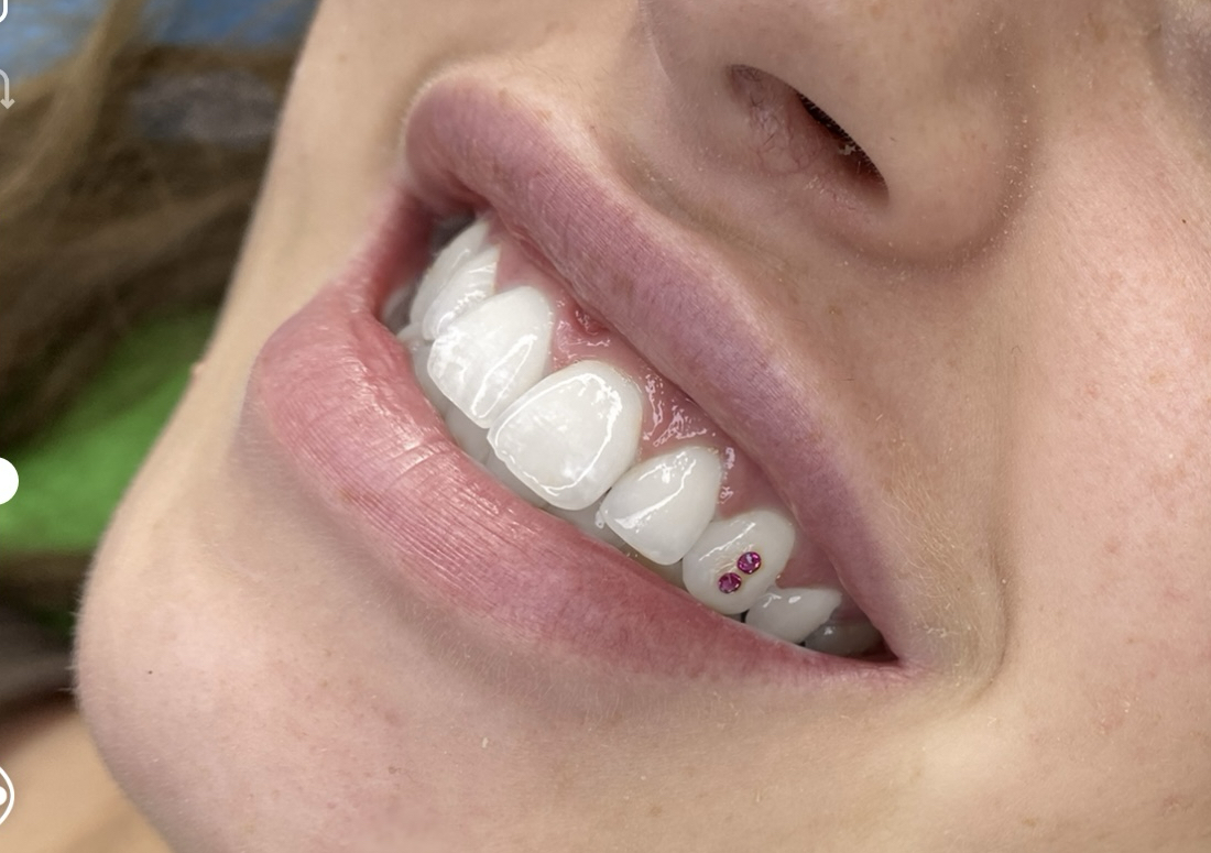 Swarovski Gem - X2 Gems