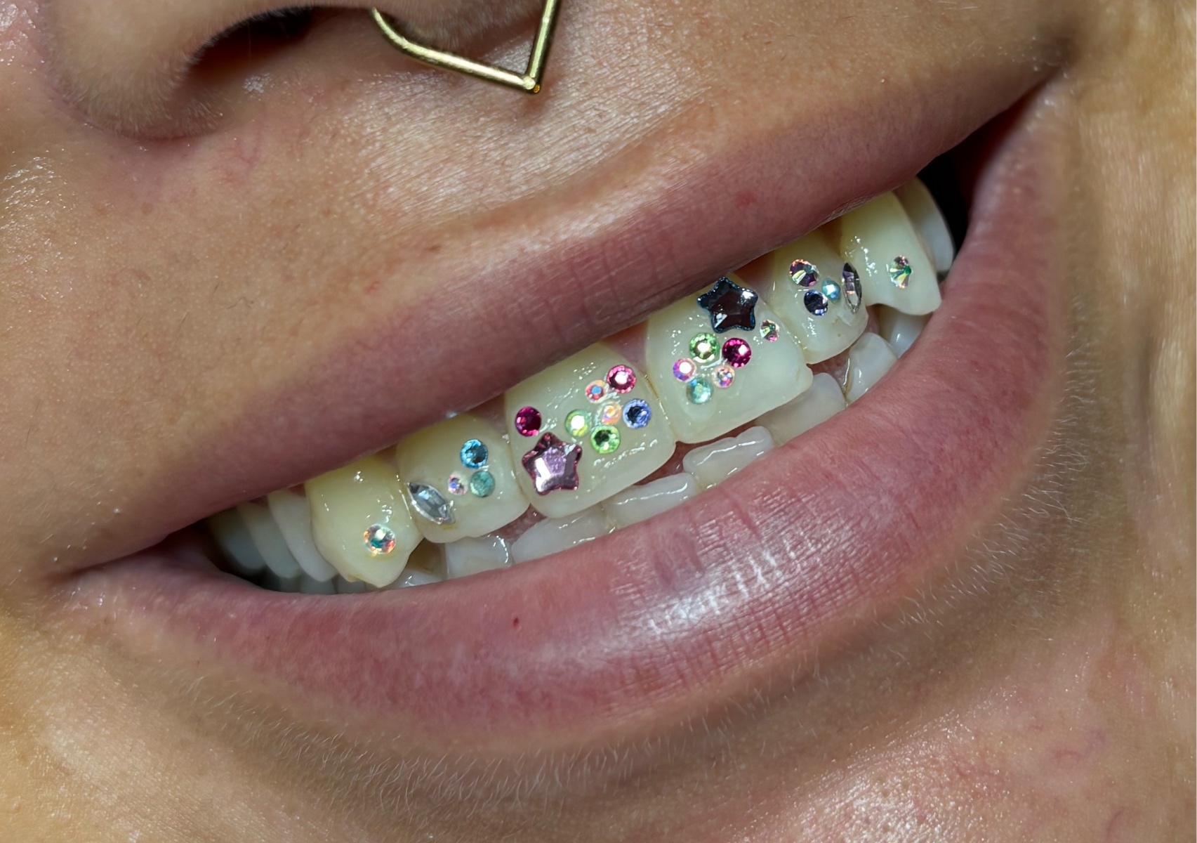 Custom Design - Complex 