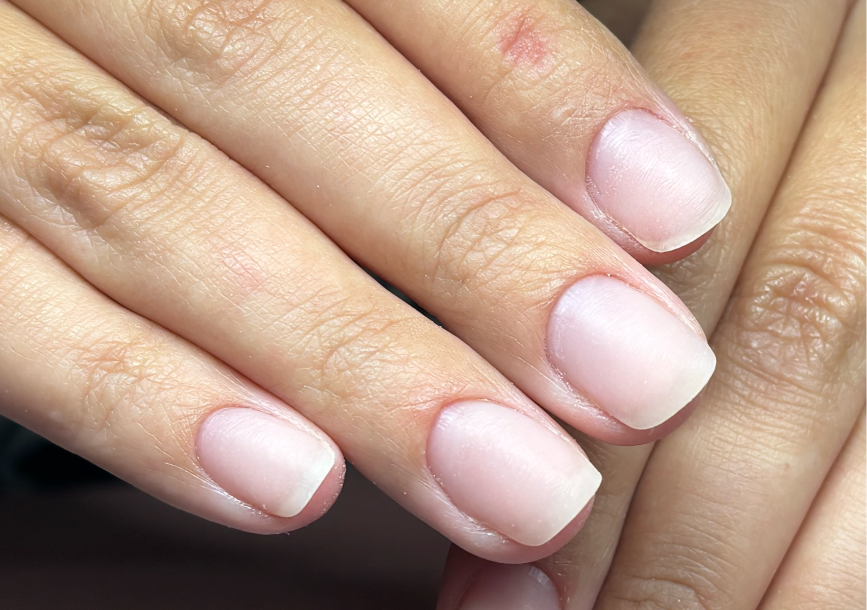 Acrylic Overlay
