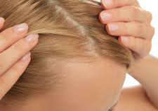 Hair Mesotheraphy / Mesoterapia Capilar 
