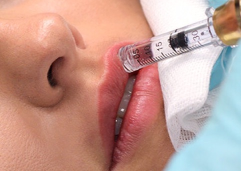 Hialouron Pen Rellena Labios de manera no invasiva -1 dia