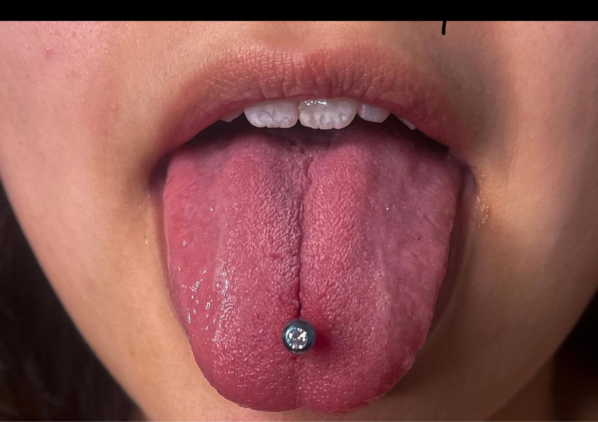 Tongue