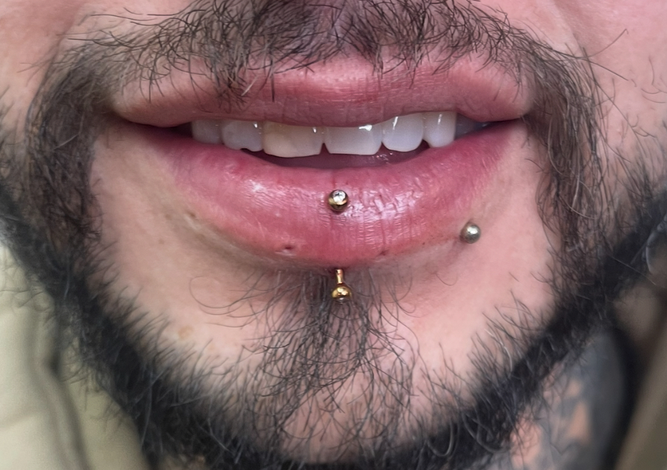 Vertical Labret