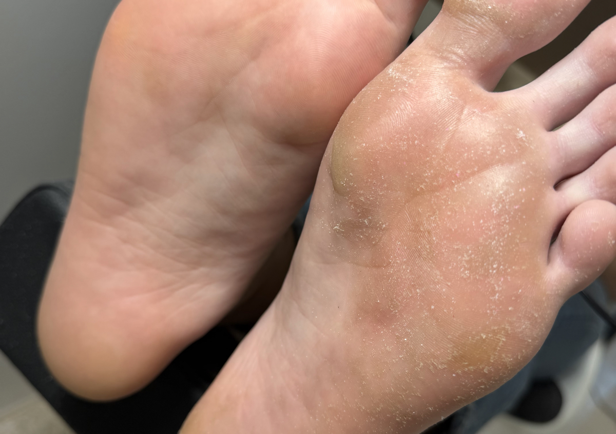 Pedicura en seco 