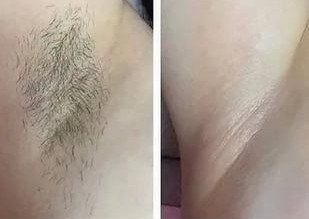 Under arm wax