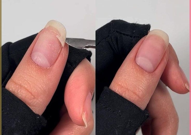 fix nail