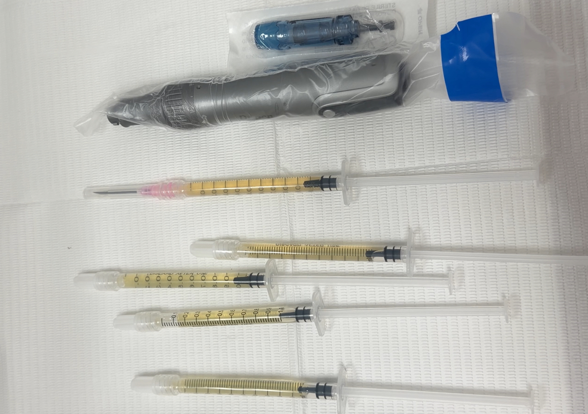 Microneeling+Plasma Rico en Plaquetas(PRP)
