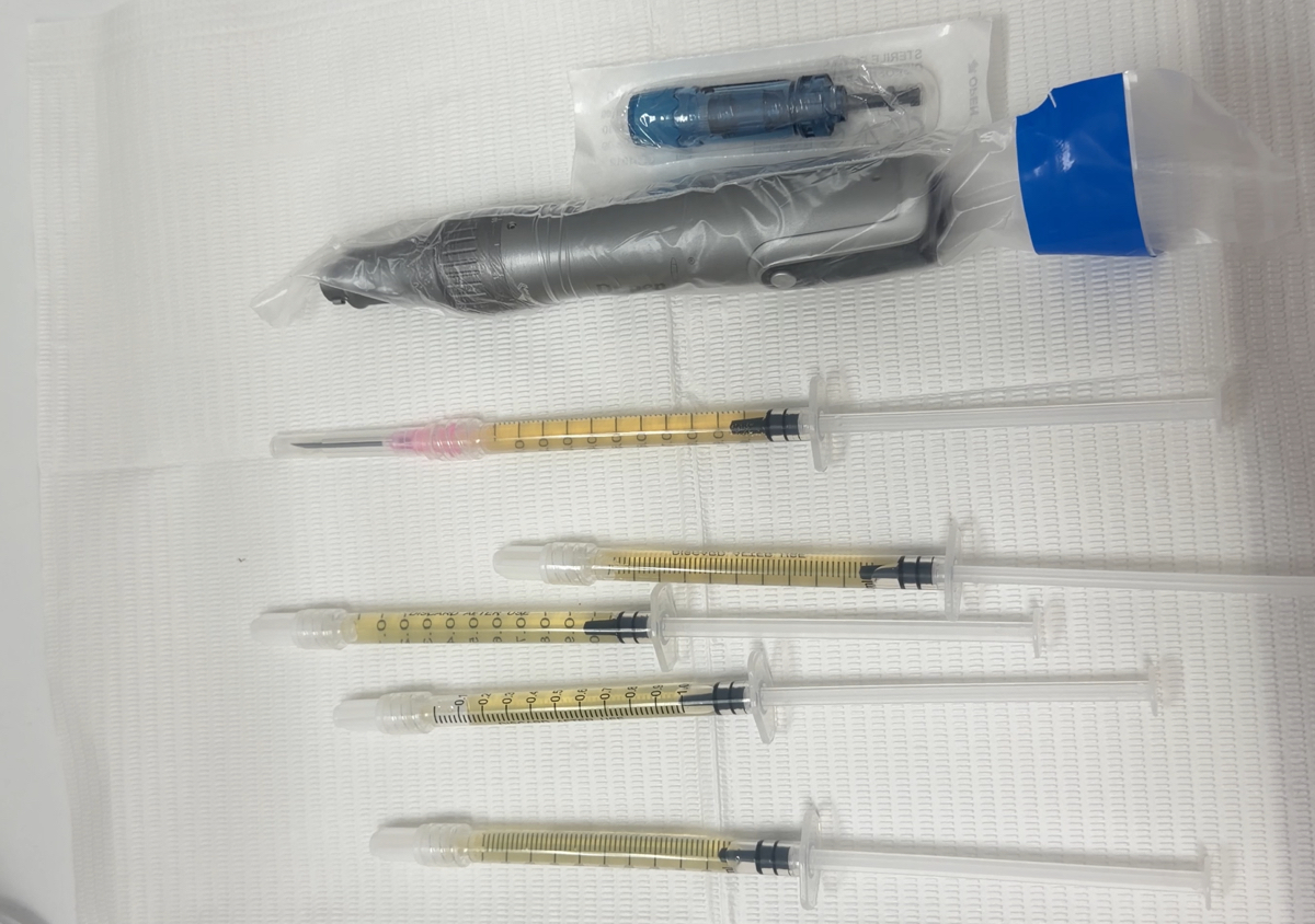 Microneeling+(PRP) 5 seccions