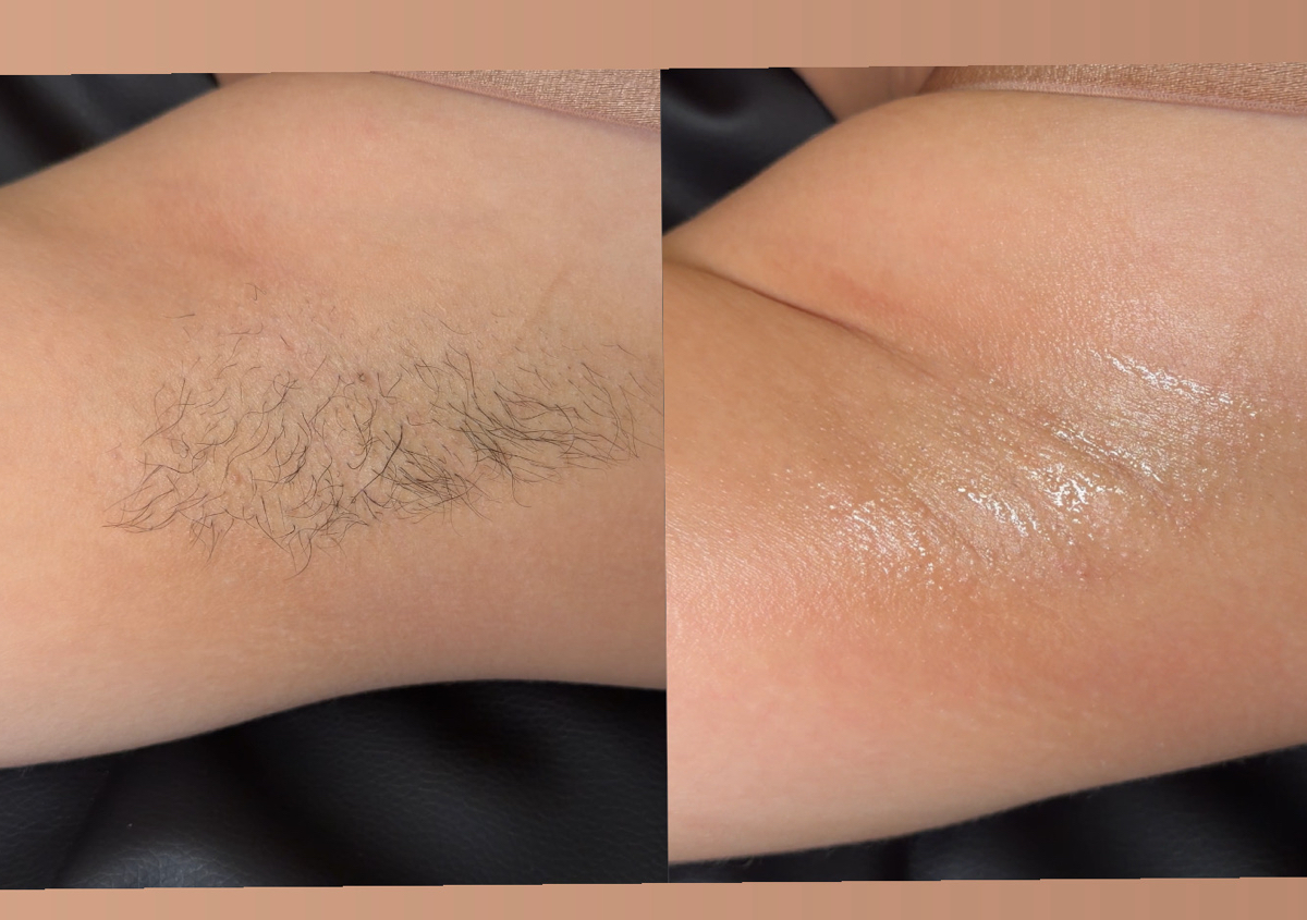 Armpits Wax