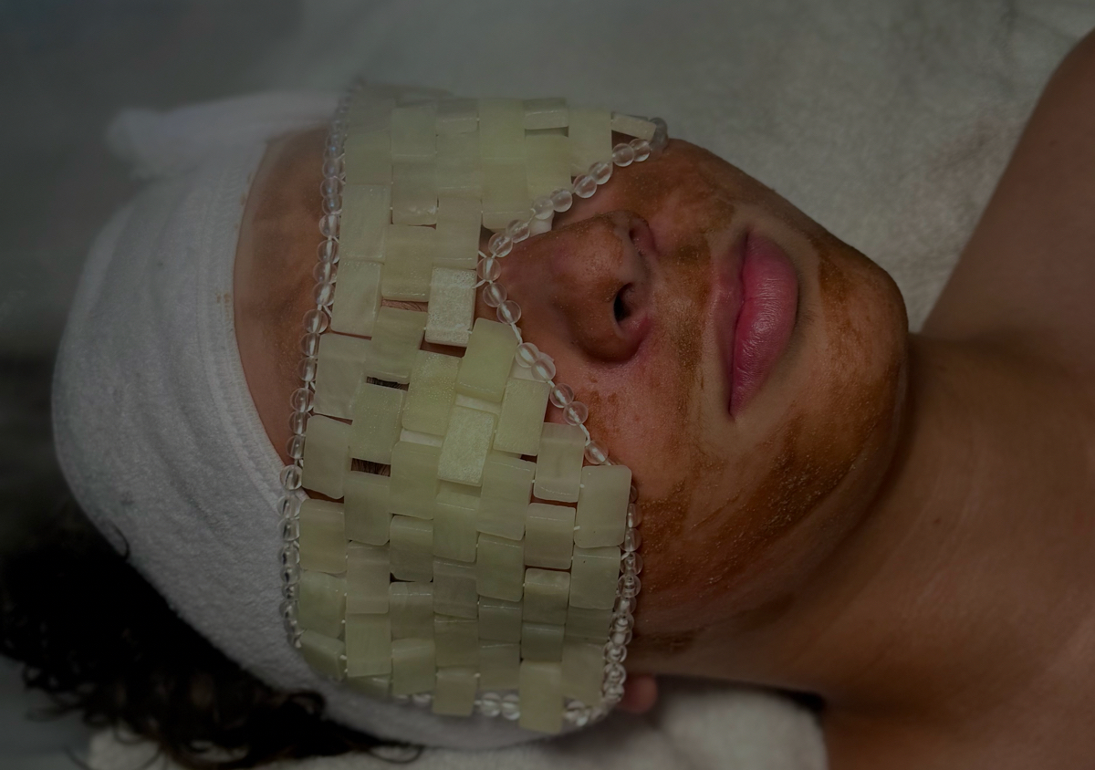 Rosacea Facial