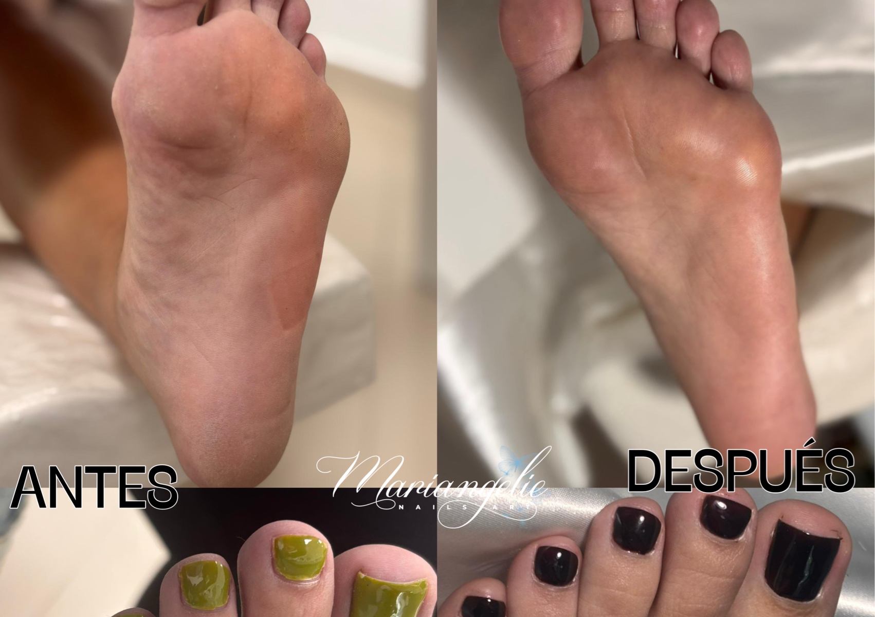 Pedicura en seco *ESMALTADO EN GEL*