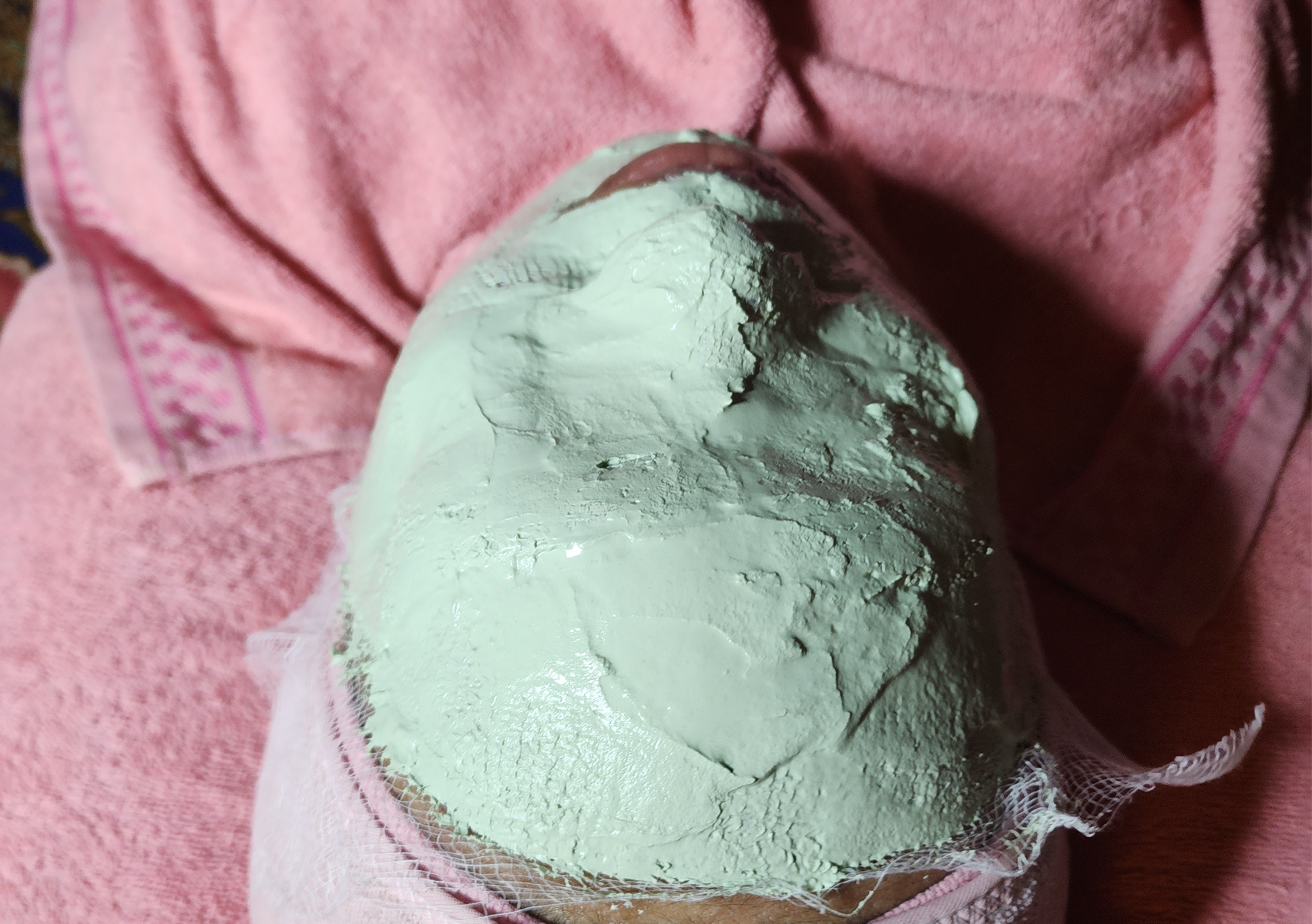 PROMO Facial Treatment + Face Cupping (Bekam wajah (jerawat) + cold mask