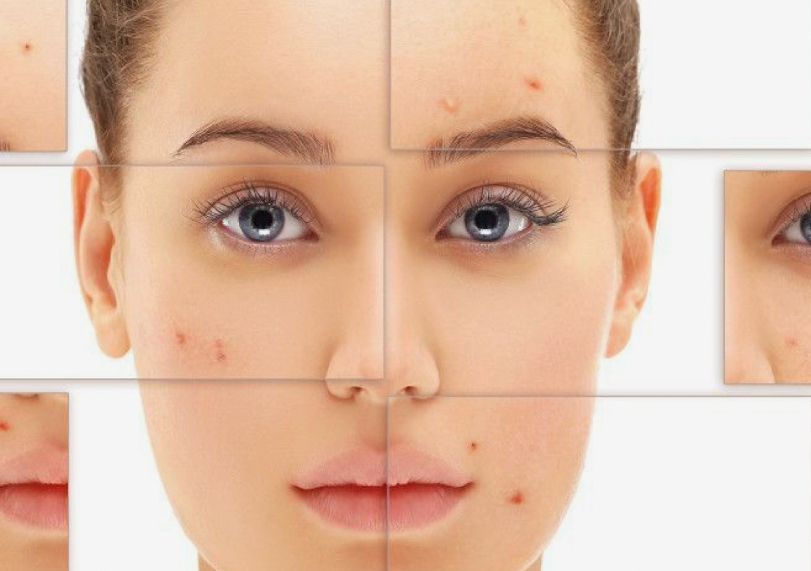 Clariskin Facial 