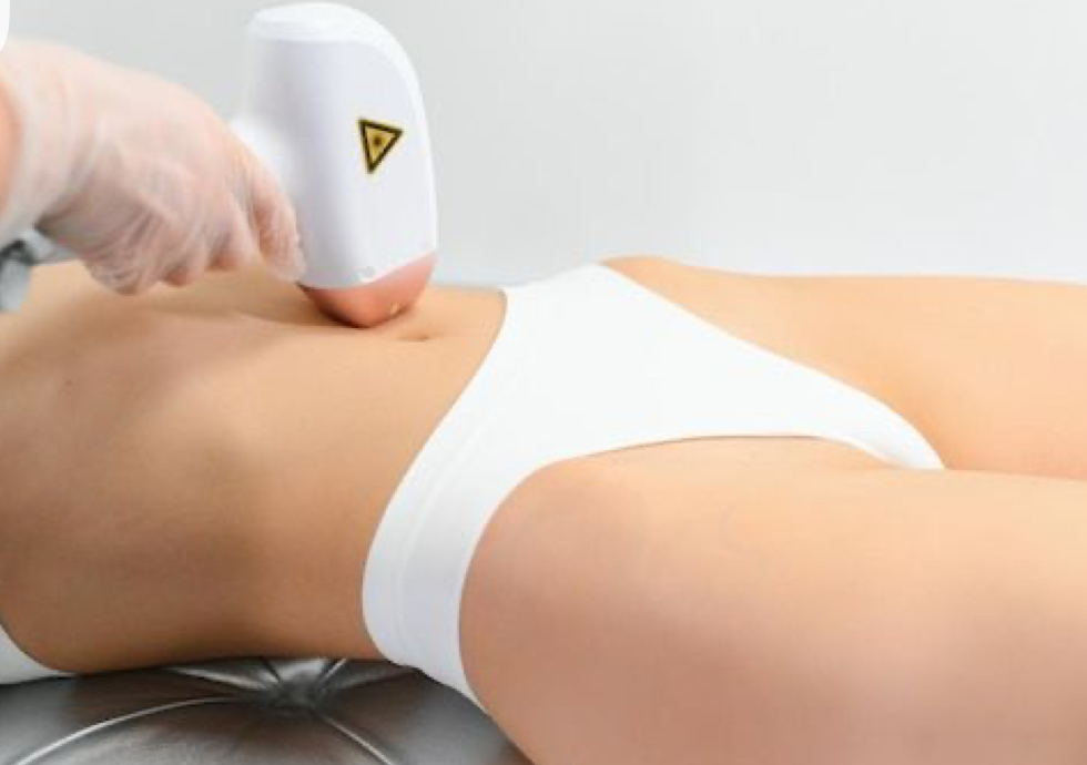 Linea abdomen 