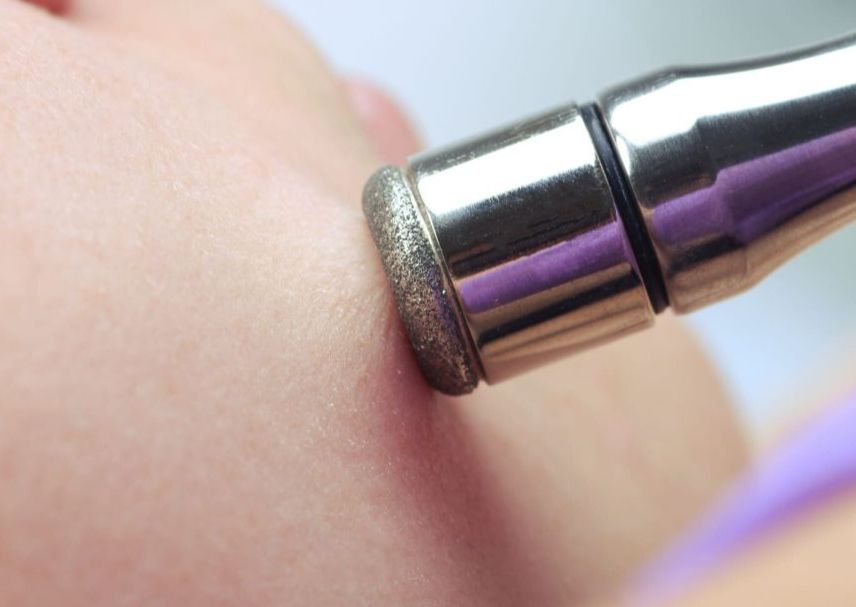 Hollywood Microdermabrasion