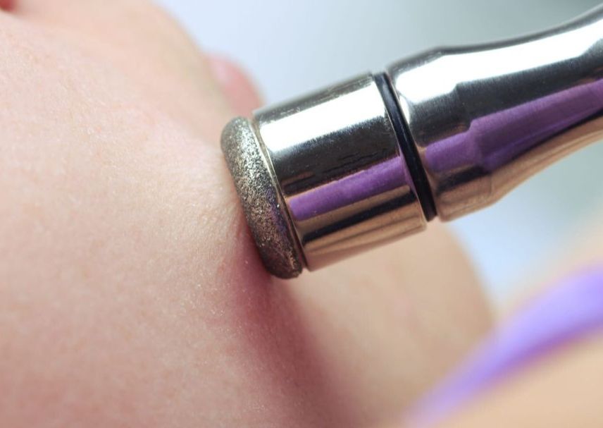 Diamond Microdermabrasion