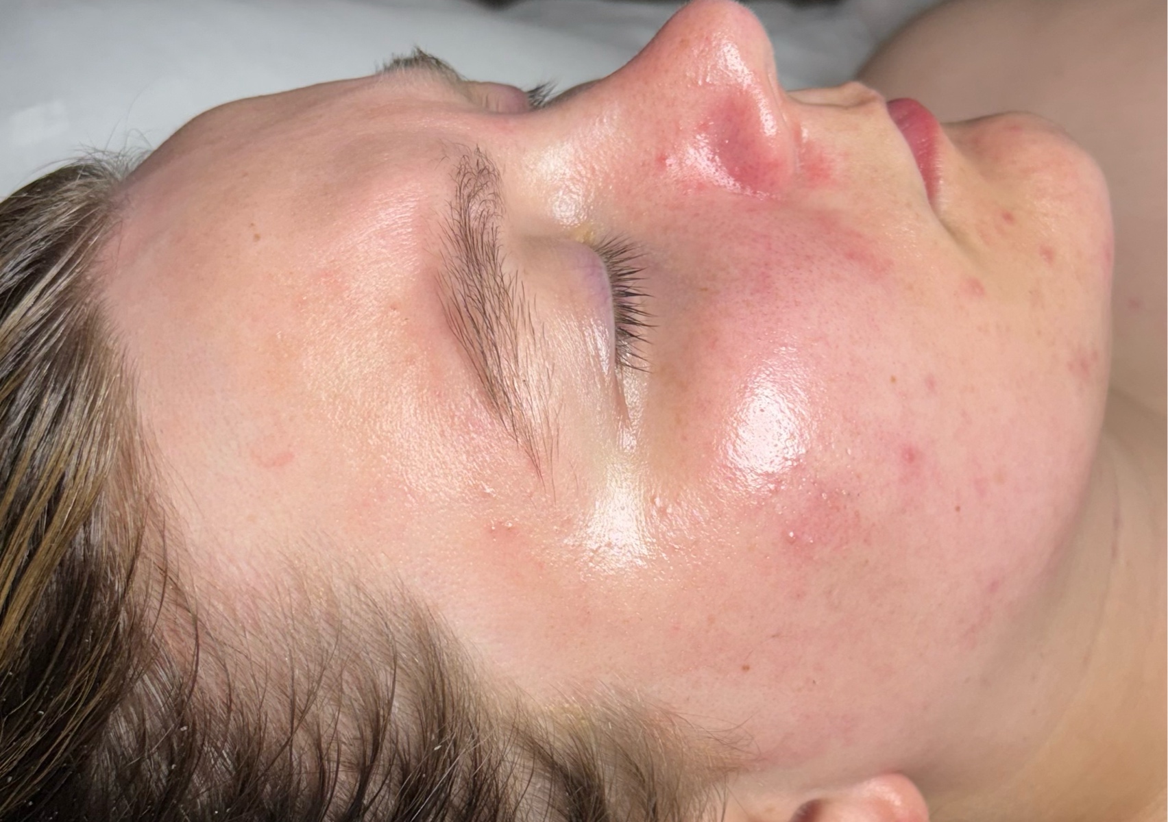 Aphrodite Deluxe Facial