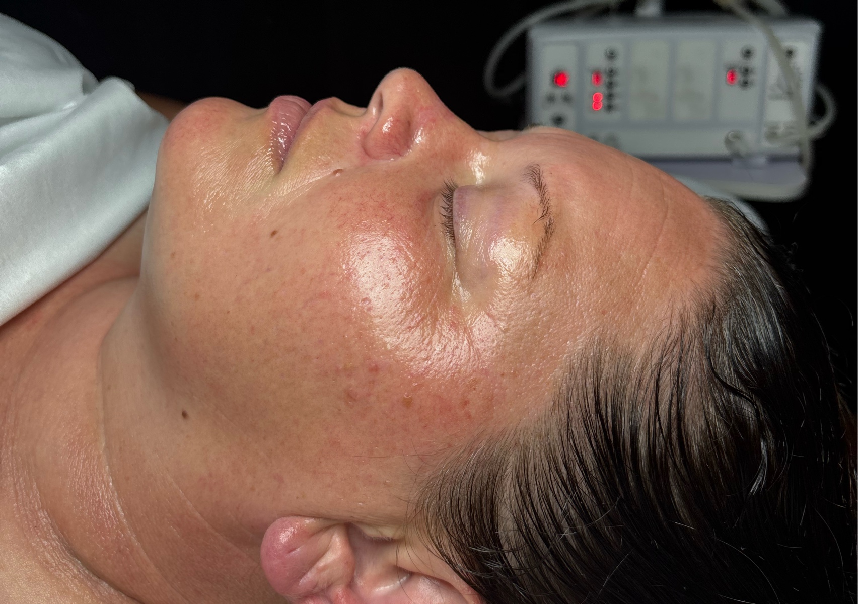 Custom Escape Facial