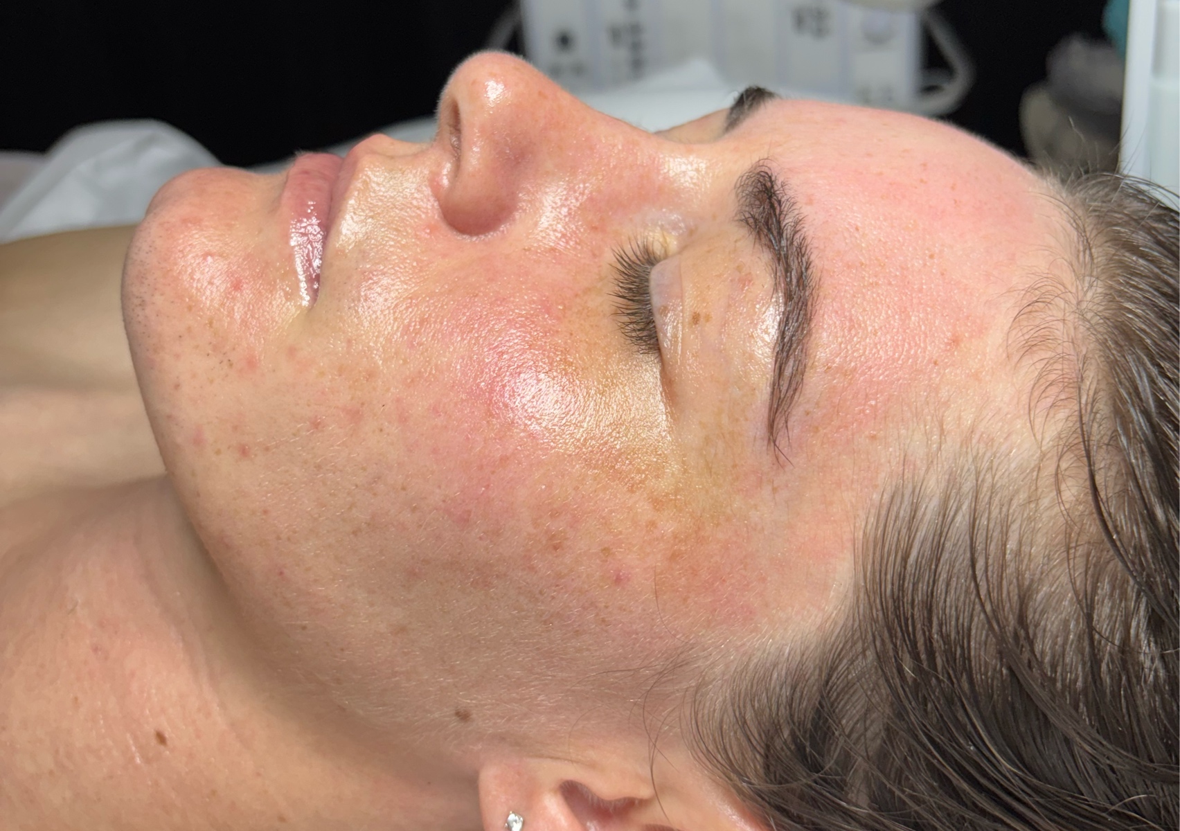 Aphrodite Facial