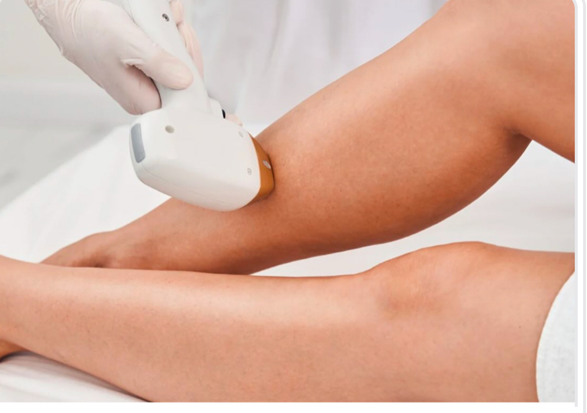 One Medium area Laser Hair Removal treatments (women only)