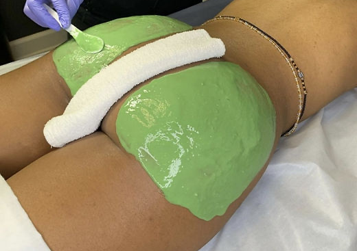 Buttock Facial with microdermabrasion (Booty Facial) ( women only)