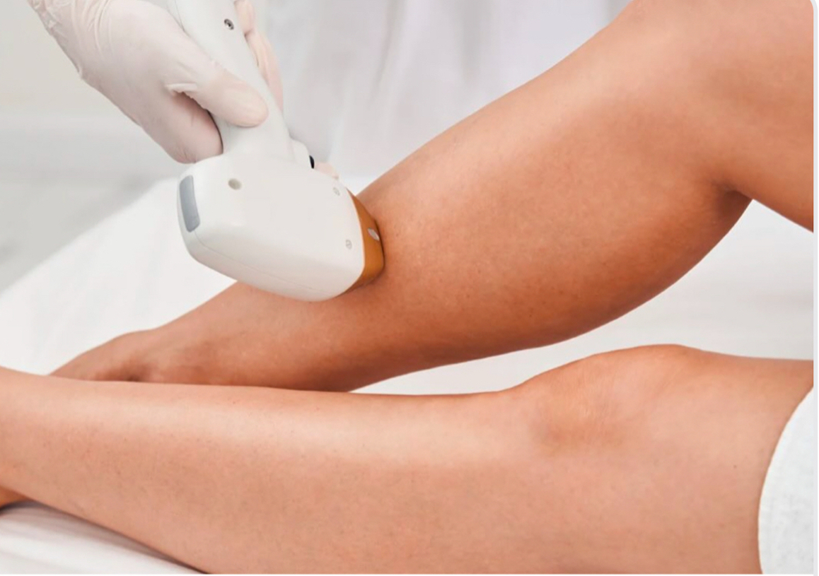 One Large area Laser Hair Removal treatments  (women only)
