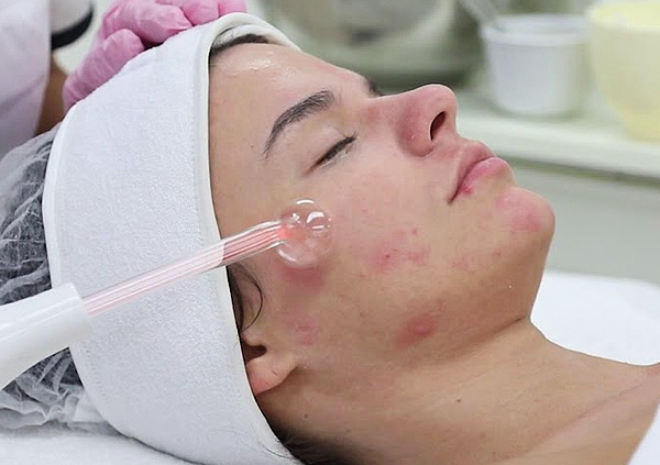 High frequency treatment (Add On)