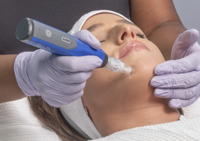 Collagen induction therapy (glass skin Facial)