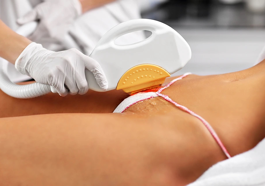 One Full Brazilian package (includes bikini, Brazilian, and perianal)