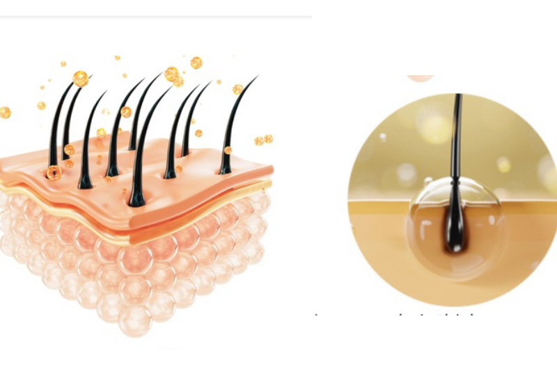 Hair growth shooter (scalp treatment)