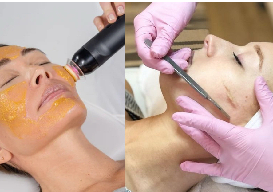 GLO𝟐 FACIAL With Dermaplaning 