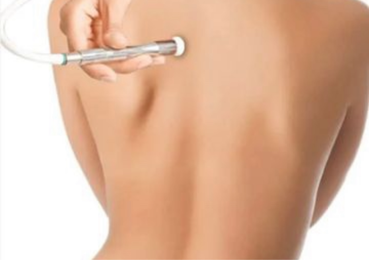 Customize back facial (women only)