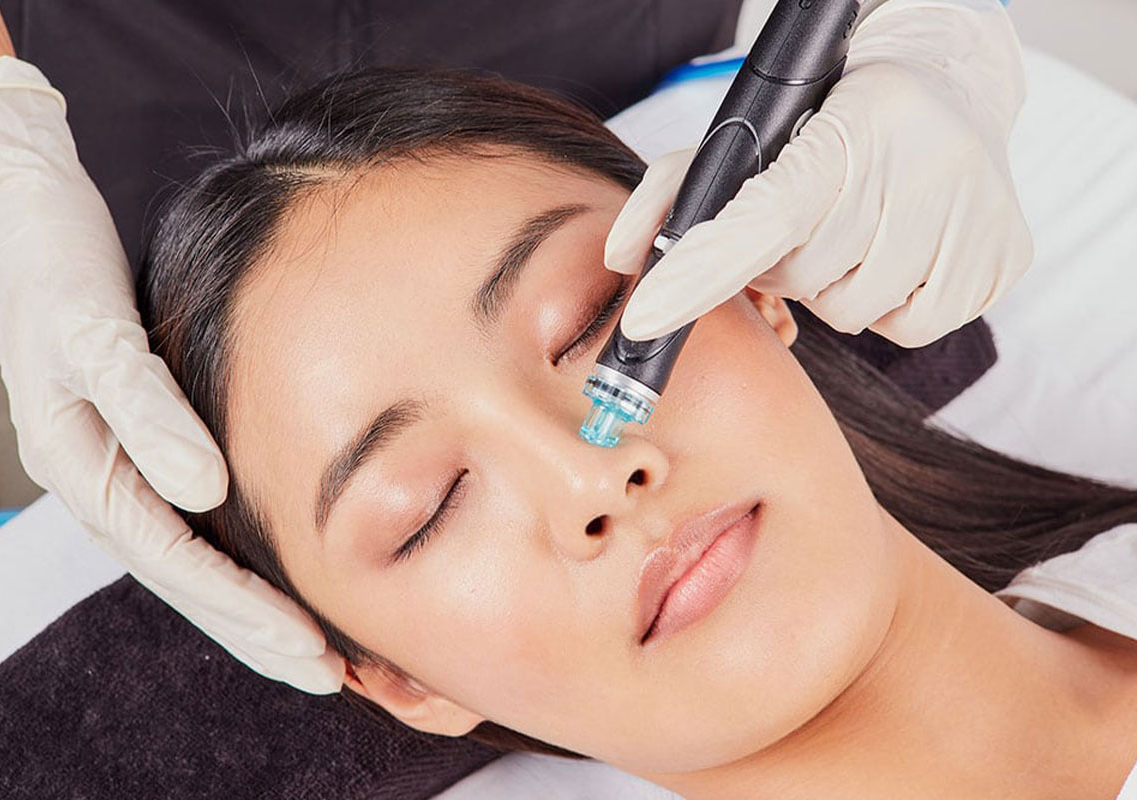  HYDRAFACIAL 