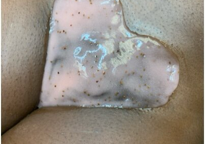 𝐕𝐀𝐉𝐀𝐂𝐈𝐀𝐋 + 𝐉𝐞𝐥𝐥𝐲 𝐌𝐚𝐬𝐤 𝐖𝐢𝐭𝐡𝐞𝐋𝐄𝐃 𝐋𝐈𝐆𝐇𝐓 𝐓𝐇𝐄𝐑𝐀𝐏𝐘