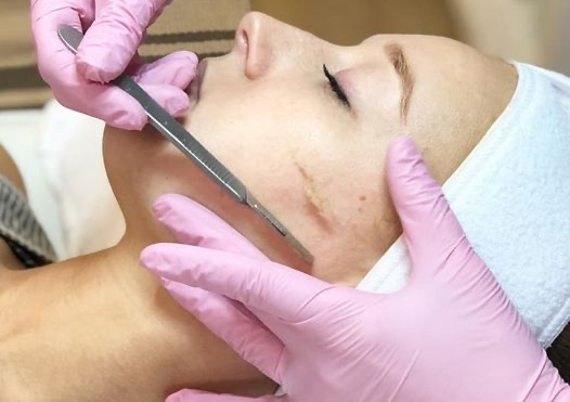 Dermaplaning Facial (Express facial )