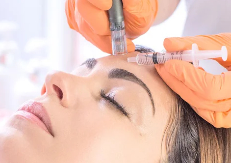 Microneedling treatment 