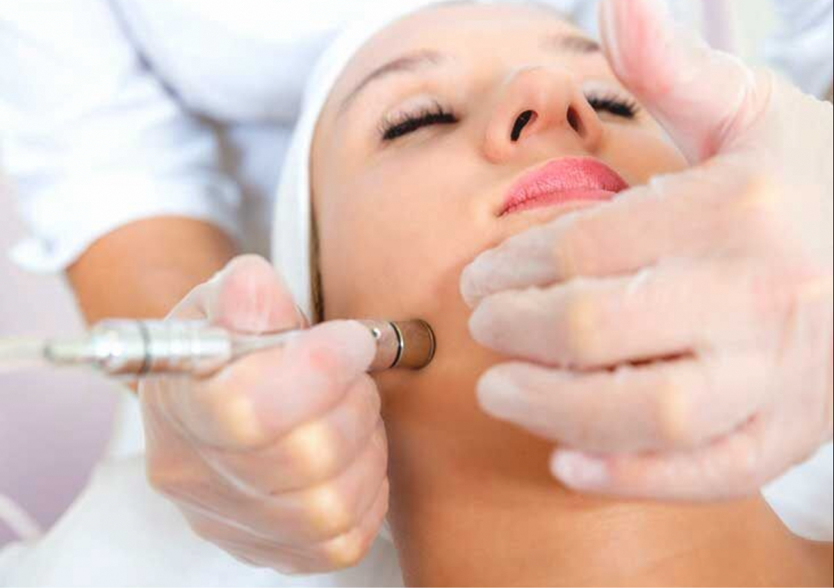 Diamond glow facial (Microdermabrasion) 