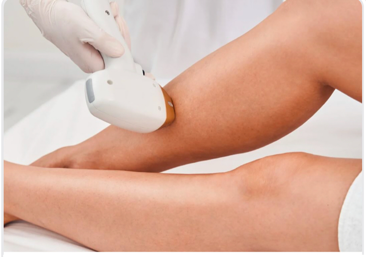 Six large area Laser Hair Removal treatments  (women only)