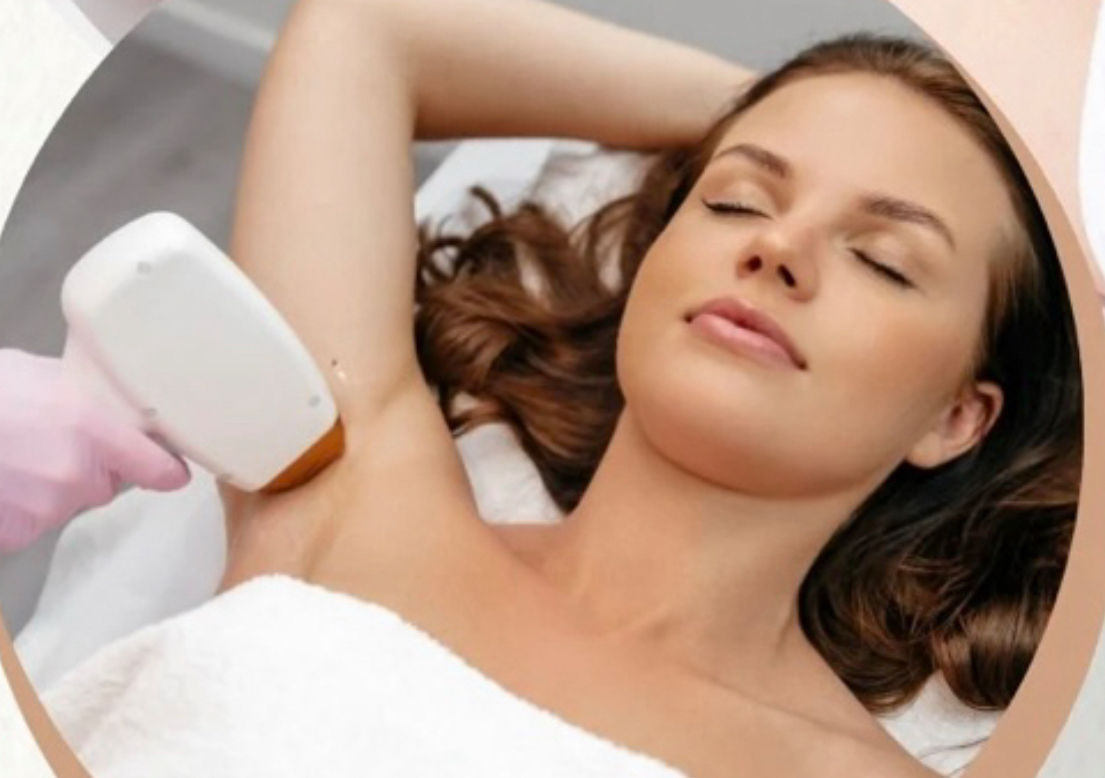  Under Arms 6 session of laser hair removal