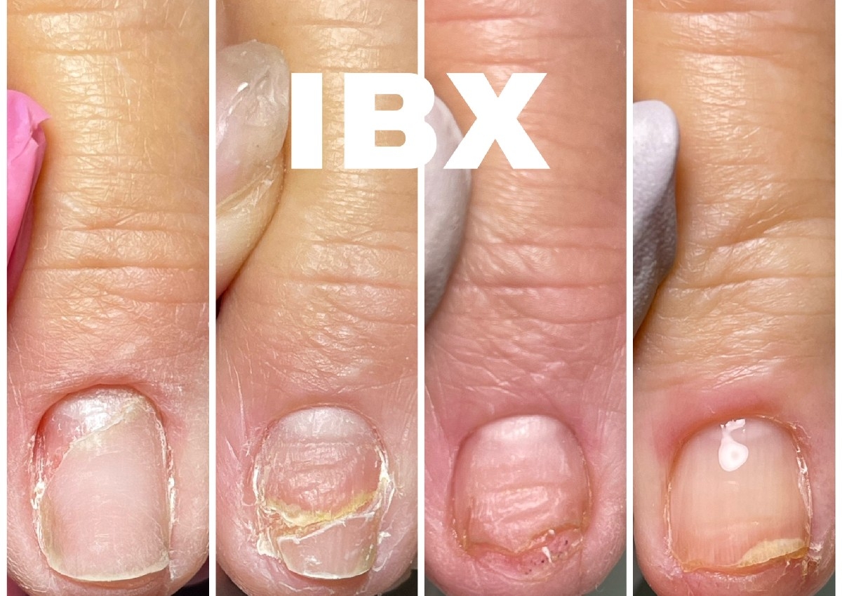 Tratamiento Reparador IBX System