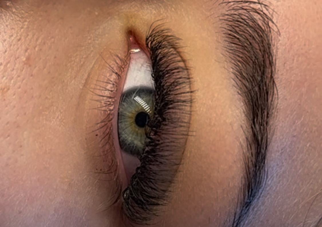 1/5d Volume Full set