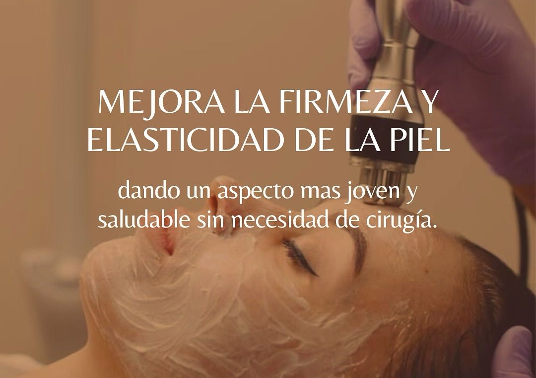 REJUVENECE CON RADIOFRECUENCIA FACIAL 