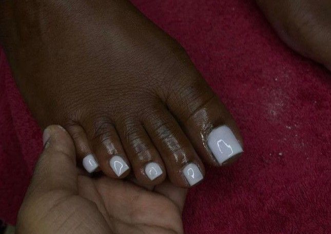 Tip on big toes w/gel