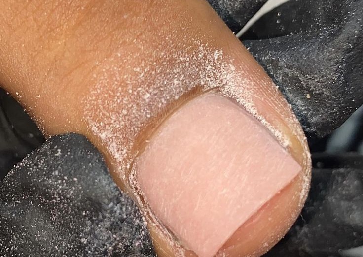 Overlay on big toe w/gel